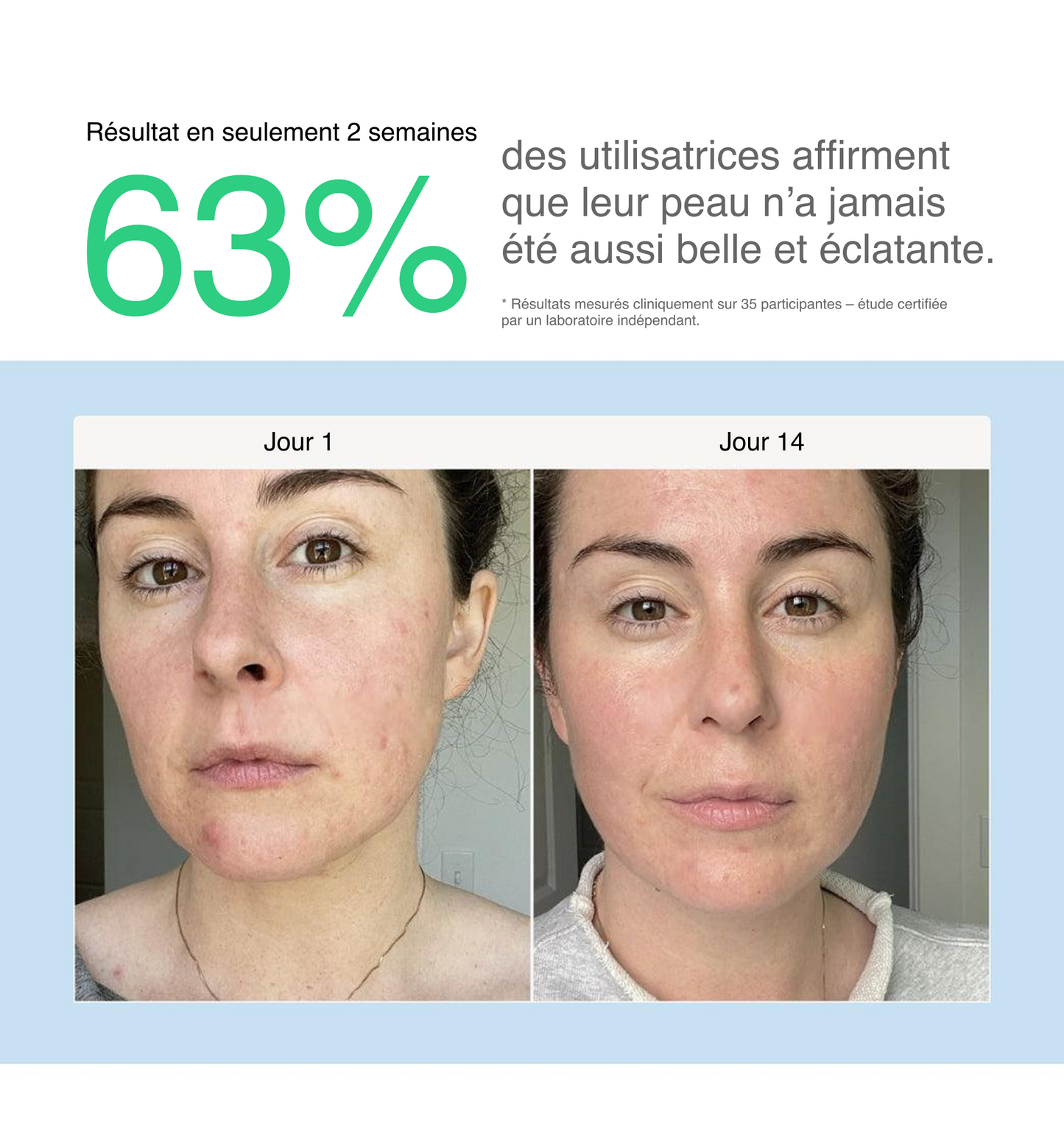 Filtre de robinet BRUME