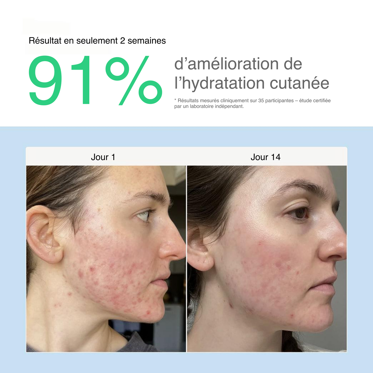 Filtre de robinet BRUME